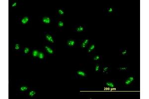 Immunofluorescence of purified MaxPab antibody to LYAR on HeLa cell. (LYAR Antikörper  (AA 1-379))