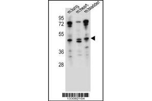 Western blot analysis in mouse lung,heart,bladder tissue lysates (35ug/lane). (NKD1 Antikörper  (N-Term))