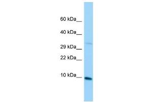 Host: Rabbit Target Name: MRPL36 Sample Type: Jurkat Whole Cell lysates Antibody Dilution: 1. (MRPL36 Antikörper  (C-Term))