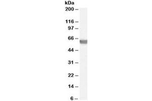Western blot testing of human testis lysate with G6PD antibody at 0. (Glucose-6-Phosphate Dehydrogenase Antikörper)