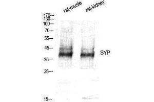 Western Blotting (WB) image for anti-Synaptophysin (SYP) (Internal Region) antibody (ABIN3187137) (Synaptophysin Antikörper  (Internal Region))