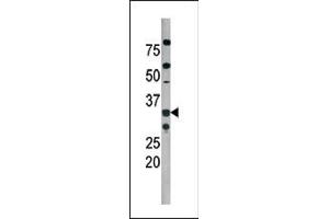 The anti-Phospho-Cdk2- Pab (ABIN389540 and ABIN2839586) is used in Western blot to detect Phospho-Cdk2- in  tissue lysate (CDK2 Antikörper  (pThr160))