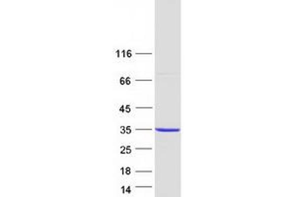 AUH Protein (Myc-DYKDDDDK Tag)