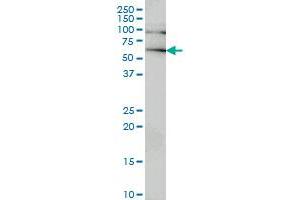 IRAK2 monoclonal antibody (M02), clone 3G6 Western Blot analysis of IRAK2 expression in HeLa . (IRAK2 Antikörper  (AA 111-210))