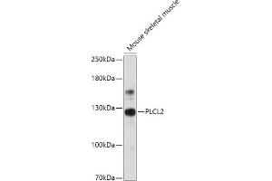 Western blot analysis of extracts of Mouse skeletal muscle, using PLCL2 antibody (ABIN7269344) at 1:1000 dilution. (PLCL2 Antikörper  (AA 130-300))