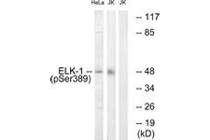 Western Blotting (WB) image for anti-ELK1, Member of ETS Oncogene Family (ELK1) (pSer389) antibody (ABIN2888404) (ELK1 Antikörper  (pSer389))