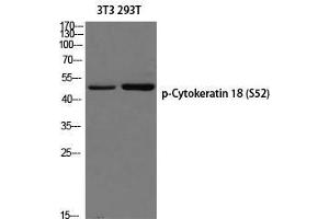 Western Blot (WB) analysis of 3T3 293T using p-Cytokeratin 18 (S52) antibody. (Cytokeratin 18 Antikörper  (pSer52))