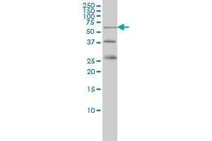 RIOK3 monoclonal antibody (M02A), clone 3G11 Western Blot analysis of RIOK3 expression in K-562 . (RIOK3 Antikörper  (AA 411-516))