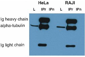 Western Blotting (WB) image for anti-alpha Tubulin (TUBA1) antibody (ABIN93891)