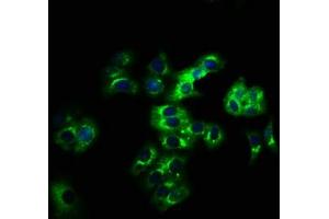 Immunofluorescence staining of HepG2 cells with ABIN7158268 at 1:166, counter-stained with DAPI. (LILRB2 Antikörper  (AA 406-563))