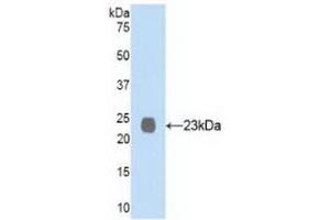 Detection of Recombinant NEP, Human using Polyclonal Antibody to Neprilysin (CD10) (MME Antikörper  (AA 565-750))