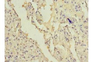 Immunohistochemistry of paraffin-embedded human lung tissue using ABIN7165382 at dilution of 1:100 (FAM124B Antikörper  (AA 146-272))
