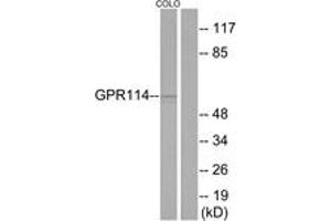Western blot analysis of extracts from COLO205 cells, using GPR114 Antibody. (GPR114 Antikörper  (AA 91-140))