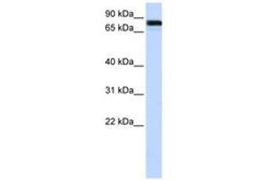 Image no. 1 for anti-Ewing Sarcoma Breakpoint Region 1 (EWSR1) (AA 216-265) antibody (ABIN6743005) (EWSR1 Antikörper  (AA 216-265))