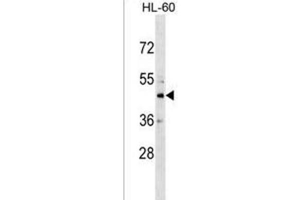 CHST10 Antikörper  (C-Term)