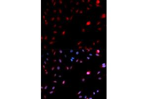 Immunofluorescence (IF) image for anti-Cyclin-Dependent Kinase 1 (CDK1) (pTyr15) antibody (ABIN1870049) (CDK1 Antikörper  (pTyr15))