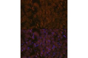Immunofluorescence analysis of human liver using MSP/MST1 Rabbit mAb (ABIN1680891, ABIN1680890, ABIN3015057 and ABIN3015058) at dilution of 1:100 (40x lens). (MST1 Antikörper)