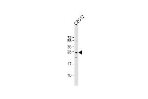 Anti-Mouse p27Kip1 Antibody (C-term ) at 1:1000 dilution + C2C12 whole cell lysate Lysates/proteins at 20 μg per lane. (CDKN1B Antikörper  (C-Term))