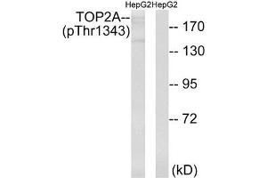 Western blot analysis of extracts from HepG2 cells treated with Ca2+ using TOP2A (Phospho-Thr1343) Antibody. (Topoisomerase II alpha Antikörper  (pThr1343))