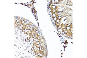 Immunohistochemistry of paraffin-embedded rat testis using TST Rabbit pAb  at dilution of 1:200 (40x lens). (TST Antikörper  (AA 1-297))