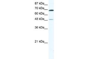 WB Suggested Anti-ZNF35 Antibody Titration:  0. (ZNF35 Antikörper  (N-Term))