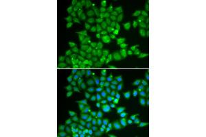 Immunofluorescence analysis of U2OS cells using PDE1B antibody. (PDE1B Antikörper)