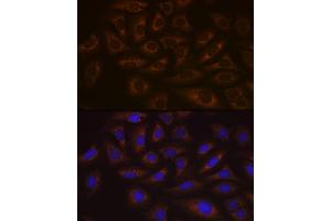 Immunofluorescence analysis of U-2 OS cells using UBE2C Rabbit mAb (ABIN1680590, ABIN3019392, ABIN3019393 and ABIN7101768) at dilution of 1:100 (40x lens). (UBE2C Antikörper)