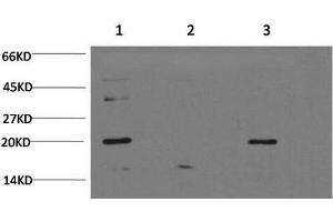 Western Blot analysis of 1) Hela, 2) C2C12, 3) PC-12 cells using Bax Monoclonal Antibody at dilution of 1:1000. (BAX Antikörper)