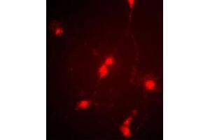 Immunofluorescence image of cultured chick retinal amacrine (neuronal) cells labeled with CLC4 Antibody (C-term) (Cat  f). (CLCN4 Antikörper  (C-Term))