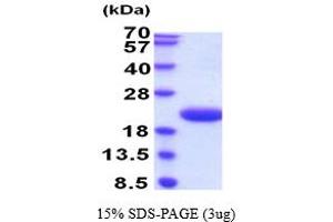 SDS-PAGE (SDS) image for Interleukin 6 (IL6) (AA 30-212) (Active) protein (ABIN5854457) (IL-6 Protein (AA 30-212))