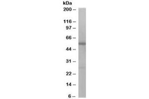 Western blot testing of Jurkat lysate with DBNL antibody at 1ug/ml. (DBNL Antikörper)
