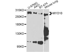 Western blot analysis of extracts of various cell lines, using MYO10 antibody. (Myosin X Antikörper)
