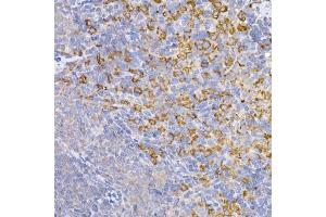 Immunohistochemistry of paraffin-embedded mouse brain using Symmetric DiMethyl-Histone H4-R3 Rabbit pAb (ABIN3017488, ABIN3017489, ABIN3017490, ABIN1680265 and ABIN6220116) at dilution of 1:100 (40x lens). (Histone H4 Antikörper  (2meArg3))