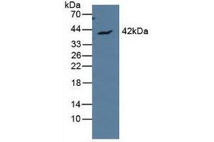 Detection of APOL1 in Human MCF7 Cells using Polyclonal Antibody to Apolipoprotein L (APOL1) (APOL1 Antikörper  (AA 1-238))