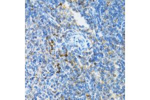 Immunohistochemistry of paraffin-embedded mouse spleen using UBE2D1 antibody (ABIN5971011) at dilution of 1/100 (40x lens). (UBE2D1 Antikörper)