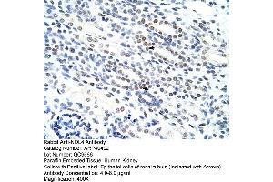 Rabbit Anti-NOL4 Antibody  Paraffin Embedded Tissue: Human Kidney Cellular Data: Epithelial cells of renal tubule Antibody Concentration: 4. (NOL4 Antikörper  (N-Term))