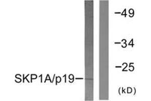 Western blot analysis of extracts from COS7 cells, using SKP1A/p19 Antibody. (SKP1 Antikörper  (AA 41-90))