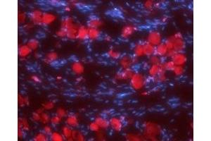 Expression of Synaptophysin in rat DRG - Immunohistochemical staining of rat dorsal root ganglia (DRG) frozen sections using Anti-Synaptophysin Antibody (ABIN7043791, ABIN7044656 and ABIN7044657), (1:100). (Synaptophysin Antikörper  (Intravesicular Loop))