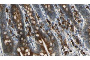 ABIN6276019 at 1/100 staining Mouse intestine tissue by IHC-P. (GPR158 Antikörper  (N-Term))