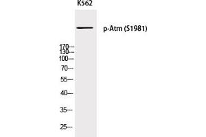 Western Blotting (WB) image for anti-Ataxia Telangiectasia Mutated (ATM) (pSer1981) antibody (ABIN5955782) (ATM Antikörper  (pSer1981))