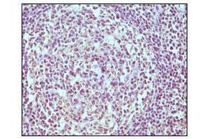 Immunohistochemical analysis of paraffin-embedded human normal lymph node, showing cytoplasmic localization using CD19 mouse mAb with DAB staining. (CD19 Antikörper)