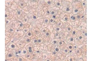 DAB staining on IHC-P; Samples: Human Liver Tissue (PLGF Antikörper  (AA 43-162))