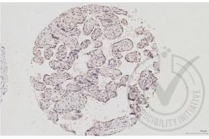 Immunohistochemistry (Paraffin-embedded Sections) (IHC (p)) image for anti-Mitogen-Activated Protein Kinase 14 (MAPK14) (pThr180), (pTyr182) antibody (ABIN678668)