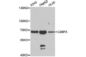 Western blot analysis of extracts of various cell lines, using C4BPA antibody (ABIN5975151) at 1/1000 dilution. (C4BPA Antikörper)