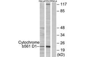 Image no. 1 for anti-Cytochrome B-561 Domain Containing 1 (CYB561D1) (AA 180-229) antibody (ABIN2889869) (CYB561D1 Antikörper  (AA 180-229))