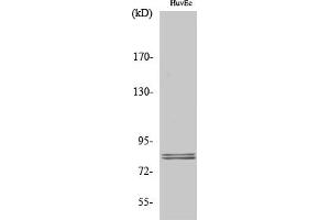 Western Blot analysis of various cells using HSL Polyclonal Antibody diluted at 1:1000. (LIPE Antikörper)