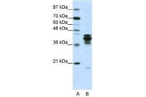 HNRPD antibody used at 1. (HNRNPD/AUF1 Antikörper)