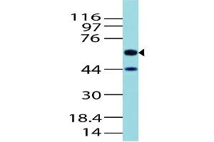 Image no. 1 for anti-Activin A Receptor Type II-Like 1 (ACVRL1) (AA 326-503) antibody (ABIN5027022) (ACVRL1 Antikörper  (AA 326-503))