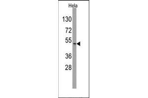 Image no. 1 for anti-Integrin-Linked Kinase (ILK) (Ser246) antibody (ABIN359882) (ILK Antikörper  (Ser246))