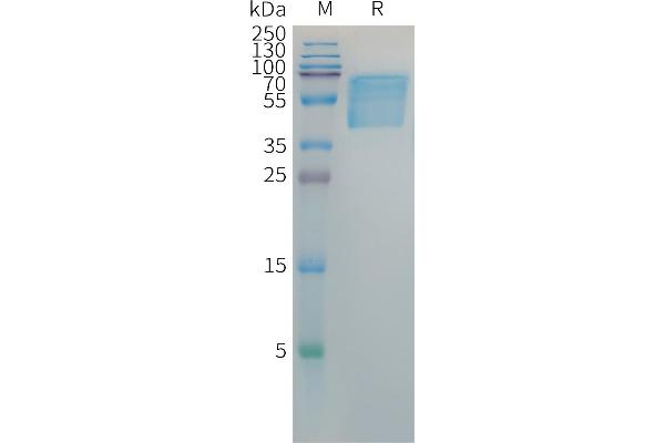 HBSAg Protein (AA 2-119) (Fc Tag)